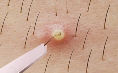 23 ОБАЛДЕННЫХ ЛАЙФХАКА ДЛЯ ИДЕАЛЬНОЙ КОЖИ