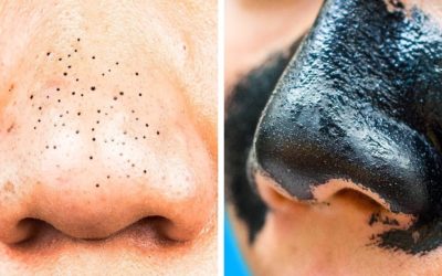 20 ПРОСТЫХ И СУПЕР-ЭФФЕКТИВНЫХ ЛАЙФХАКОВ С АКТИВИРОВАННЫМ УГЛЕМ