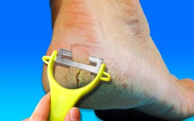 26 ЛАЙФХАКОВ ДЛЯ ТЕЛА, КОТОРЫЕ ОБЛЕГЧАТ ВАШУ ЖИЗНЬ